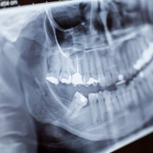 X-ray Close-up